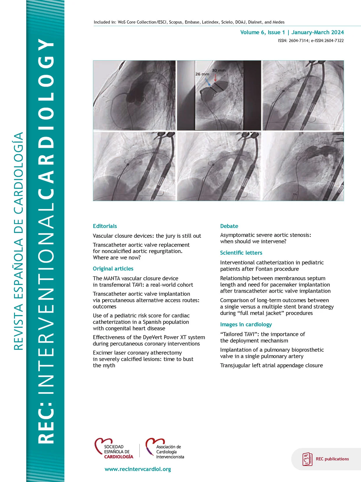 Revista Española de Cardiología