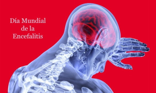 De Febrero D A Mundial De La Encefalitis Jano Es Elsevier