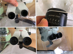 A) Pantalla de metacrilato adaptada al microscopio tras retirar el binocular. B) Adaptación del binocular al metacrilato que permite manipular la distancia interpupilar. C) Adaptación del binocular al microscopio junto a la pantalla de metacrilato. D) Pantalla de plástico interpuesta y recambiable para mejorar el sellado del metacrilato.