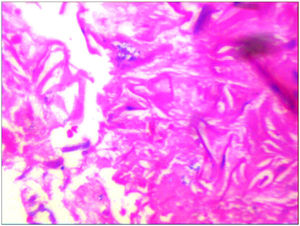 Histopathology section showing ribbon-like aseptate hyphae (haematoxylin and eosin stain × 400).