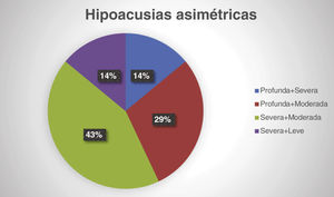 Distribución de las hipoacusias asimétricas.
