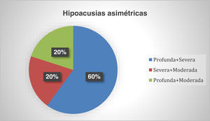 Distribución de las hipoacusias asimétricas.