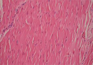 Detalle histológico del centro de la lesión, donde se logra apreciar tejido muscular esquelético maduro. Hematoxilina-eosina, x10.