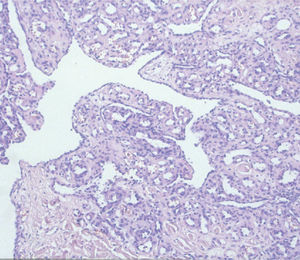 Canales vasculares de pared delgada compuestos por células endoteliales. Hematoxilina-eosina, ×200.