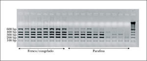 PCR de control de calidad del ADN. Control de calidad del ADN obtenido de muestras frescas/congeladas y en parafina. La banda de mayor tamaño indica el tamaño máximo amplificable mediante PCR de un segmento de ADN.
