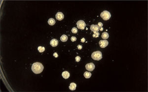 Típicas colonias de M. globosa en medio mDixon.