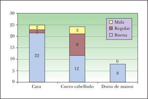 Tolerancia por localizaciones.