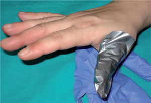 Dediles de guantes 4H utilizados como medida de protección.