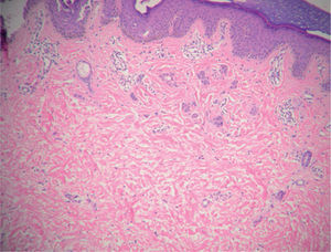 Hematoxilina-eosina, ×10.