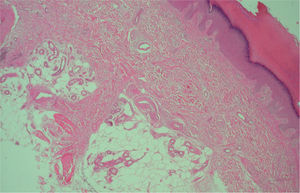 Hematoxilina-eosina, ×10.
