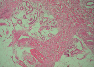 Hematoxilina-eosina, ×60.
