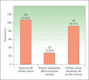 Patrón histológico de distribución de las células claras. CE: carcinoma espinocelular.