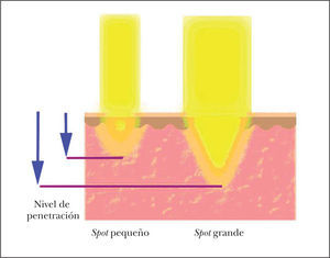 Representación de la relación entre el tamaño de spot y la capacidad de penetración en la piel para una misma longitud de onda determinada.