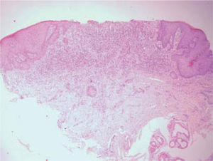 Hematoxilina-eosina, ×10.