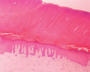 Corte histológico orientado en sentido perpendicular a los dermatoglifos. (Hematoxilina-eosina, ×10)