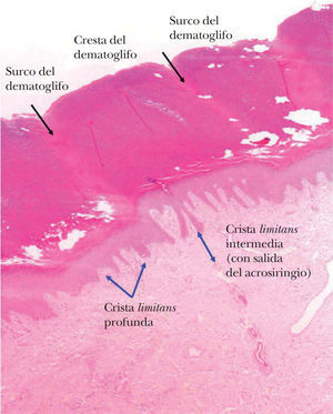 Esquema de la anatomía de la piel volar. (Hematoxilina-eosina, ×10)