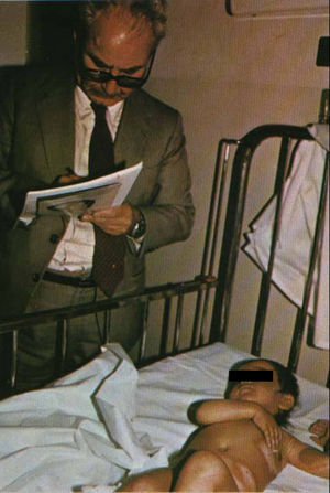 El Dr. Manuel Domínguez Carmona, miembro del equipo de inspectores de la ONU en la guerra Irán-Iraq, examina a una niña afectada por iperita en 1987. Cortesía del Dr. Shahriar Khateri.