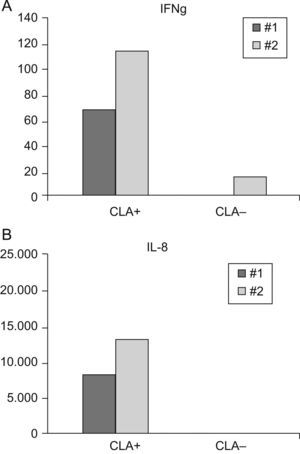 Expresión génica de IFNγ (A) e IL-8 (B) en los subgrupos de linfocitos T CLA+ y CLA− de psoriasis. Los resultados han sido normalizados a partir de la GAPDH, según la fórmula 1,8−ΔCt * 10.000.
