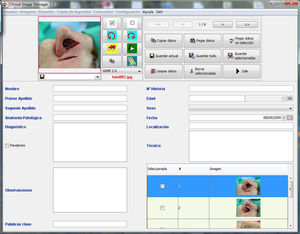 Ejemplo de utlización del CIM 2.0 para imágenes dermatológicas. Los datos de filiación pueden importarse desde el sistema informático del hospital.