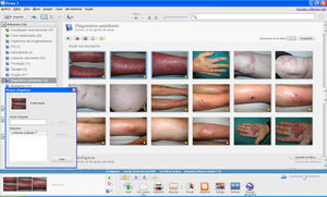 Asignación de etiquetas a imágenes dermatológicas según el diagnóstico mediante Picasa 3.