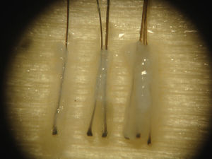 Unidades foliculares de 1, 2 y 3 pelos tras ser diseccionadas al microscopio.