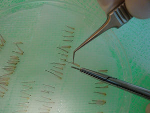 Las unidades foliculares, según el número de folículos que contengan, se mantienen hidratadas en todo momento en placas de Petri hasta su implantación.