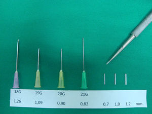 Agujas hipodérmicas y cuchillas rectangulares utilizadas para la realización de las incisiones en la zona receptora. Se describe su calibre y el diámetro de la incisión que producen. A la derecha se muestra el mango del bisturí en el que se acoplan las cuchillas.