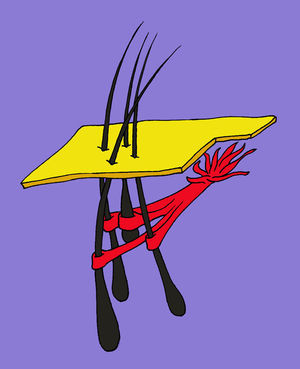 Todos los músculos erectores de cada folículo se unen formando una única unidad muscular. Fotografía tomada de Poblet et al20.