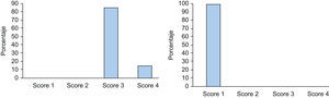 Escala de severidad de hiperhidrosis axilar previa al tratamiento con TB-A (izquierda) y dos meses después (derecha) (n=20).