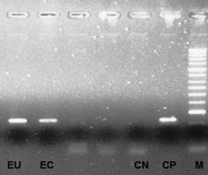 Visualización de las bandas 241pb del plásmido críptico de la Chlamydia trachomatis, después de la exposición a UV del gel de agarosa a 1,5% en el exudado uretral (EU) del paciente y en el exudado cervical (EC) de la pareja. CN (control negativo: agua destilada adicionada en la mezcla de la reacción), CP (control positivo, extirpe L2434B propagada en células McCoy), M (marcador de pesos moleculares: HyperLadder II® da Bioline).