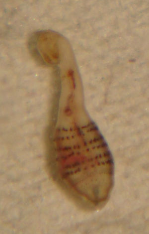 Larva L2 de Dermatobia hominis. Se observa su característica morfología en «botella» así como la presencia de varios anillos formados por estructuras negras que se corresponden a ganchos de quitina.