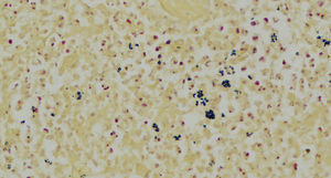 Detalle: cocobacilos Gram positivos en los microabscesos de la dermis media y profunda (tinción de Gram x10).