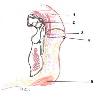 Esquema del labio mucoso: 1. Labio. 2: Molar. 3: Arteria labial. 4: Borde cutáneo del bermellón. 5: Músculo mentoniano.