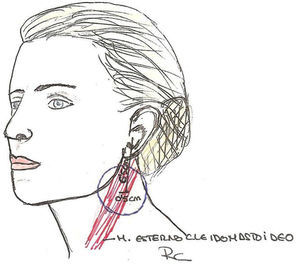 Localización del punto de Erb en el cuello.