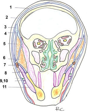 Esquema resumen de los planos en la cabeza. Corte coronal. 1: Galea/ SMAS. 2: Fascia temporoparietal/SMAS. 3: Fascia temporoparietal profunda. 4: Línea de fusión. 5: Cuerpo adiposo temporal. 6: Cuerpo adiposo bucal. 7: Arco cigomático. 8: Músculo temporal. 9: Conducto parotídeo. 10: Rama bucal del nervio facial. 11: Músculo masetero.