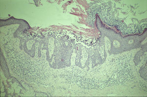 Hematoxilina-eosina x10.
