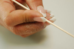 Eccema de manos localizado en los pulpejos de los tres primeros dedos en una esteticista que trabaja con uñas artificiales. Posible sensibilización a acrilatos.