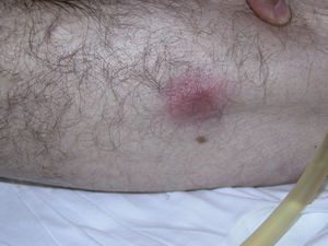 Figura 1