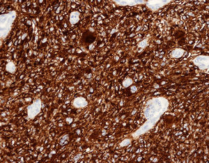 Marcador CD10. 10x.