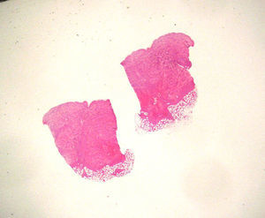 Hematoxilina-eosina ×10.