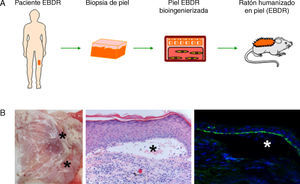 Desarrollo de modelos humanizados de enfermedades cutáneas raras o de baja prevalencia. (A) La piel humana regenerada en ratones inmunodeficientes a partir de células obtenidas de pacientes con epidermólisis bullosa distrófica recesiva (EBDR) recapitula el fenotipo severo de dicha patología (B) como se comprueba clínica e histológicamente por la presencia de ampollas (H&E, 20×) (que se señalan con asteriscos) y la localización de colágeno VII en el techo de las mismas (colágeno VII, 20×).