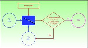 Metodología quirúrgica aplicada en la simpaticotomía videotoracoscópica para el tratamiento del blushing.