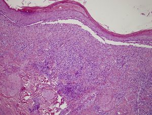 Hematoxilina-eosina 10×.
