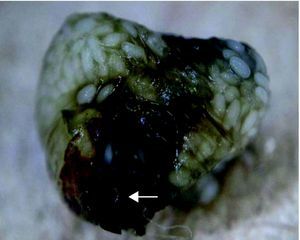 Imagen de la pulga una vez extraida. Con epiluminiscencia se observan multitud de huevos en la cavidad abdominal de la pulga.