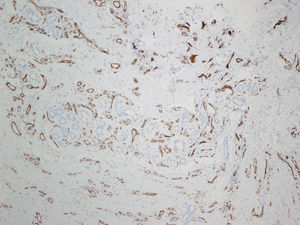 Tinción inmunohistoquímica CD31 x10.