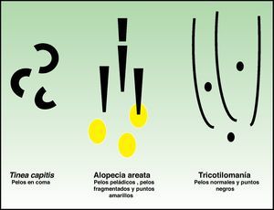 Esquema del diagnóstico diferencial mediante los hallazgos de la tricodermatoscopia.