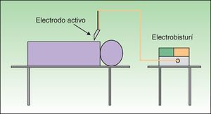 Circuito bipolar: la electricidad fluye entre los 2 extremos de la pinza (electrodo activo) sin pasar por el paciente.