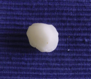 Cera para huesos moldeada.