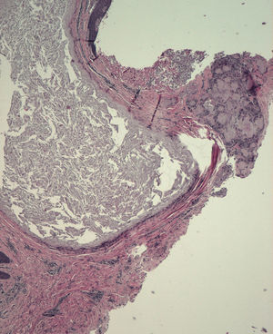 Hematoxilina-eosina, ×10.