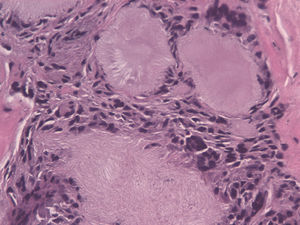 Hematoxilina-eosina, ×40.
